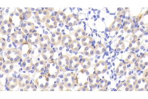 Detection of FABP1 in Rat Kidney Tissue using Polyclonal Antibody to Fatty Acid Binding Protein 1 (FABP1) (FABP1 anticorps  (AA 1-127))