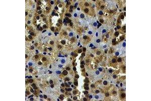 Immunohistochemical analysis of USP7 staining in human kidney formalin fixed paraffin embedded tissue section. (USP7 anticorps)
