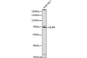 Western blot analysis of extracts of R. (IL2 Receptor beta anticorps  (AA 27-240))