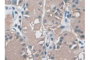 Detection of MHCB in Human Stomach Tissue using Polyclonal Antibody to Major Histocompatibility Complex Class I B (MHCB)