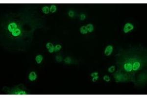 Anti-TP53 mouse monoclonal antibody (ABIN2454550) immunofluorescent staining of COS7 cells transiently transfected by pCMV6-ENTRY TP53 (RC200003). (p53 anticorps)