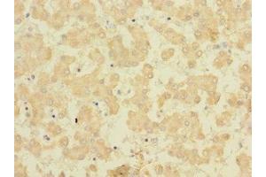 Immunohistochemistry of paraffin-embedded human liver tissue using ABIN7165454 at dilution of 1:100 (FAM187B anticorps  (AA 18-335))