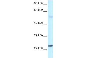WB Suggested Anti-RAB31 Antibody Titration: 1. (RAB31 anticorps  (C-Term))