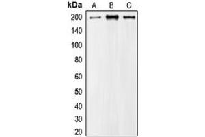Western blot analysis of MRCK alpha expression in A549 (A), HeLa (B), NIH3T3 (C) whole cell lysates. (CDC42BPA anticorps  (Center))
