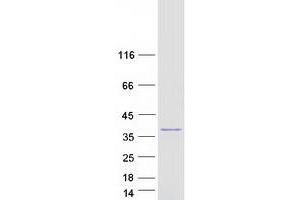 Thiosulfate Sulfurtransferase (Rhodanese) (TST) protein (Myc-DYKDDDDK Tag)