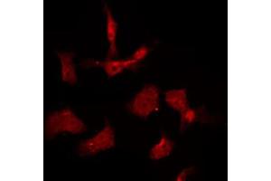 ABIN6267009 staining K562 by IF/ICC. (AKT1/3 anticorps)