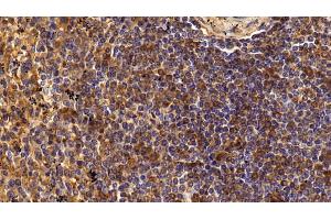 Detection of CD4 in Human Spleen Tissue using Polyclonal Antibody to Cluster Of Differentiation 4 (CD4)