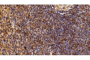 Detection of CD4 in Human Spleen Tissue using Polyclonal Antibody to Cluster Of Differentiation 4 (CD4) (CD4 anticorps  (AA 27-394))