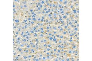 Immunohistochemistry of paraffin embedded rat liver using THNSL2 (ABIN7075893) at dilution of 1: 400 (400x lens)