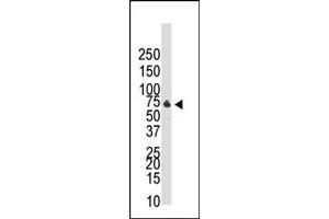 Image no. 1 for anti-Bone Morphogenetic Protein Receptor, Type IB (BMPR1B) (C-Term) antibody (ABIN357379)