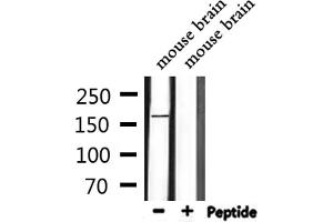 Western blot analysis of extracts from mouse brain, using LMTK2 Antibody. (LMTK2 anticorps  (Internal Region))