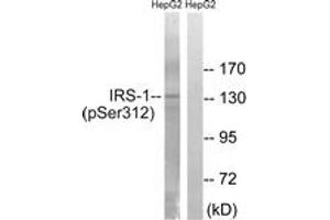 Western blot analysis of extracts from HepG2 cells, using IRS-1 (Phospho-Ser312) Antibody. (IRS1 anticorps  (pSer312))
