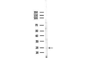 anti-Peroxisomal Biogenesis Factor 11 beta (PEX11B) (Internal Region) antibody