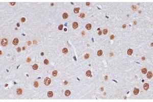 Immunohistochemistry of paraffin-embedded Rat brain using PELP1 Polyclonal Antibody at dilution of 1:100 (40x lens). (PELP1 anticorps)
