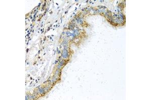 Immunohistochemistry of paraffin-embedded human trachea using ATPIF1 antibody.