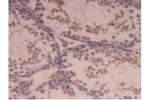 Detection of CPB2 in Mouse Testis Tissue using Polyclonal Antibody to Carboxypeptidase B2 (CPB2)