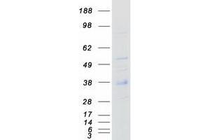 Validation with Western Blot
