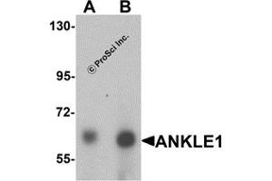 Western Blotting (WB) image for anti-Ankyrin Repeat and LEM Domain Containing 1 (ANKLE1) (C-Term) antibody (ABIN1030236) (ANKLE1 anticorps  (C-Term))
