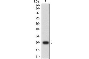 Western blot analysis using CCNE1 mAb against human CCNE1 (AA: 1-100) recombinant protein. (Cyclin E1 anticorps  (AA 1-100))