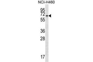 BEND4 Antibody (N-term) western blot analysis in NCI-H460 cell line lysates (35µg/lane). (BEND4 anticorps  (N-Term))