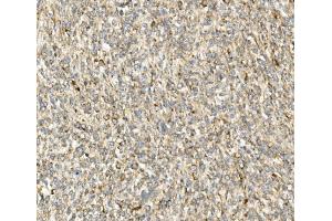 IHC analysis of DDIT3 using anti-DDIT3 antibody (ABIN7599026).