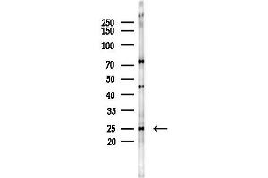 anti-TIMP Metallopeptidase Inhibitor 4 (TIMP4) (C-Term) antibody