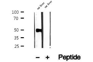 Western blot analysis of extracts of rat liver tissue, using PMPCB antibody. (PMPCB anticorps  (Internal Region))