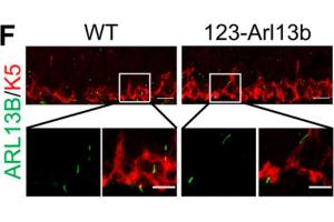 Representative confocal images of WT and Dp10 mouse embryonic fibroblasts.