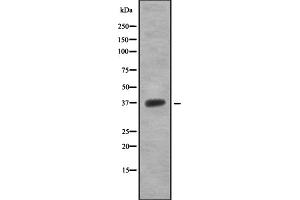 Western blot analysis OR5T1 using 293 whole cell lysates (OR5T1 anticorps)