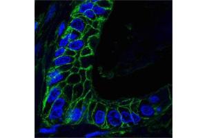 Confocal analysis of paraffin-embedded human lung cancer tissues using CD44 mouse mAb (green), showing membrane localization.