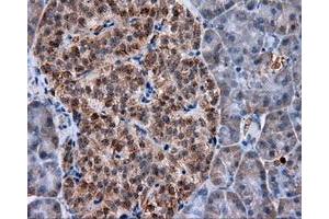Immunohistochemical staining of paraffin-embedded liver tissue using anti-MTRF1L mouse monoclonal antibody. (MTRF1L anticorps)