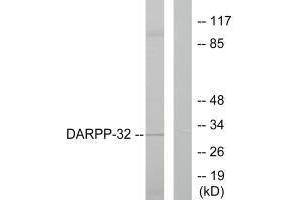 Western blot analysis of extracts from 293 cells treated with EGF (200 ng/mL, 30 min), using DARPP-32 (Ab-75) antibody. (DARPP32 anticorps  (Thr75))