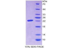 SDS-PAGE (SDS) image for Microfibrillar Associated Protein 2 (MFAP2) (AA 6-162) protein (His tag) (ABIN2125859)