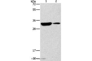 Western blot analysis of Mouse heart and brain tissue, using RCAN1 Polyclonal Antibody at dilution of 1:500 (RCAN1 anticorps)