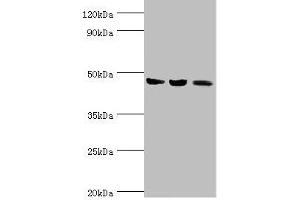 Western blot All lanes: ACAT1 antibody at 6 μg/mL Lane 1: Mouse skeletal musce tissue Lane 2: Rat heart tissue Lane 3: THP-1 whole cell lysate Secondary Goat polyclonal to rabbit IgG at 1/10000 dilution Predicted band size: 46, 18 kDa Observed band size: 46 kDa