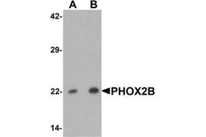 Western blot analysis of PHOX2B in 293 cell lysate with PHOX2B Antibody  at (A) 1 and (B) 2 ug/mL. (PHOX2B anticorps  (Middle Region))
