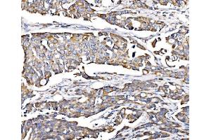 IHC analysis of PMPCA/INPP5 using anti-PMPCA/INPP5 antibody (ABIN7602722). (PMPCA anticorps  (AA 99-525))