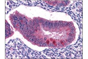 Immunohistochemistry Image: Human Uterus: Formalin-Fixed, Paraffin-Embedded (FFPE)