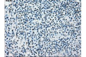 Immunohistochemical staining of paraffin-embedded Adenocarcinoma of colon tissue using anti-PRKYmouse monoclonal antibody. (PRKY anticorps)