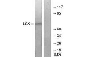 Western blot analysis of extracts from 293 cells, treated with serum 15% 10', using Lck (Ab-393) Antibody. (LCK anticorps  (AA 361-410))