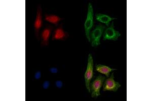 ABIN7093914 and ABIN7097958 staining HepG2 cells by IF/ICC. (MED12 anticorps  (Internal Region))