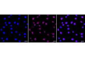 Immunocytochemical staining of C2C12 cells with Lysine demethylase 4A antibody (ABIN7799301), 1:1,000).