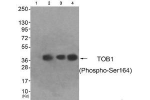 Western blot analysis of extracts from HeLa cells (Lane 2), A549 cells (Lane 3) and HepG2 cells (Lane 4), using TOB1 (Phospho-Ser164) Antibody. (Protein Tob1 (TOB1) (pSer164) anticorps)