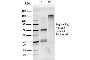 SDS-PAGE Analysis Purified Estrogen Receptor alpha Mouse Monoclonal Antibody (ESR1/3559).