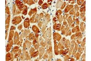 Immunohistochemistry of paraffin-embedded human heart tissue using ABIN7163159 at dilution of 1:100