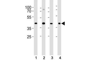 Western blot analysis of lysate from (1) HeLa, (2) U-87 MG, (3) rat C6 cell line and (4) mouse heart tissue lysate using Connexin 43 antibody at 1:1000.