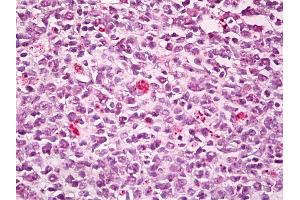 Anti-SWAP70 antibody IHC of human tonsil, germinal center.