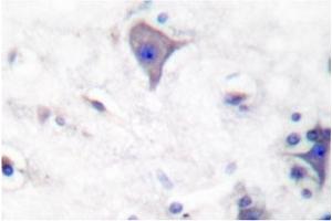 Image no. 2 for anti-Claudin 5 (CLDN5) antibody (ABIN265364) (Claudin 5 anticorps)