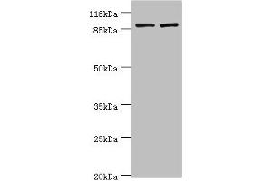 Western blot All lanes: GCC1 antibody at 2 μg/mL Lane 1: Hela whole cell lysate Lane 2: 293T whole cell lysate Secondary Goat polyclonal to rabbit IgG at 1/10000 dilution Predicted band size: 88 kDa Observed band size: 88 kDa (GCC1 anticorps  (AA 4-775))