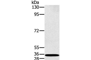 Western Blot analysis of K562 cell using RAB27A Polyclonal Antibody at dilution of 1:400 (RAB27A anticorps)